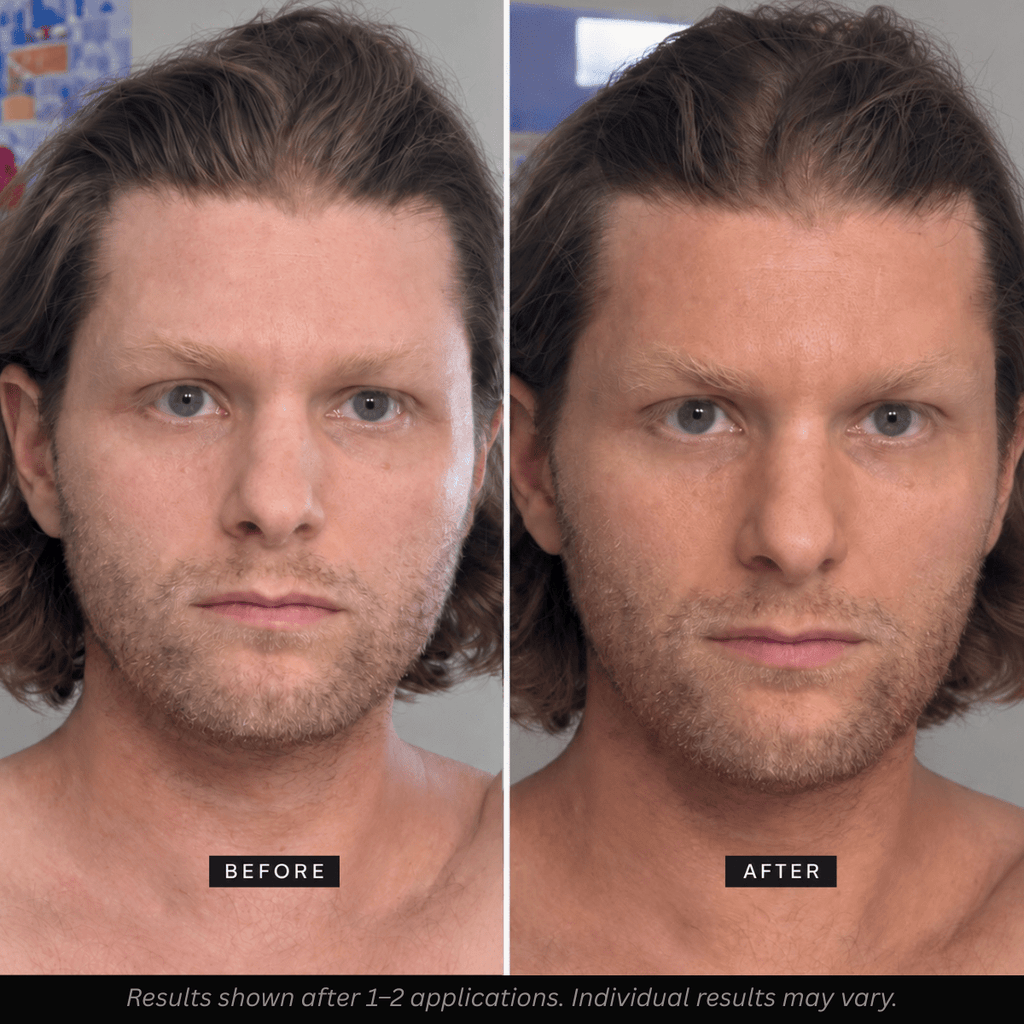 Bronze Age Face Tanner - Bronze Age