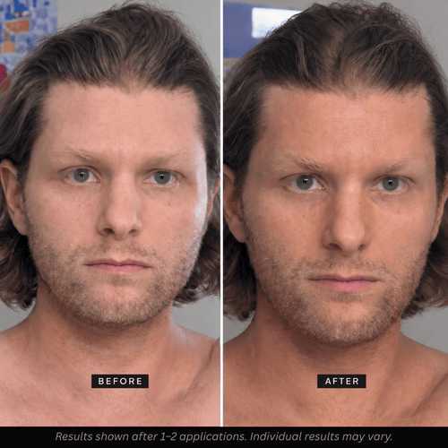Bronze Age Face Tanner - Bronze Age